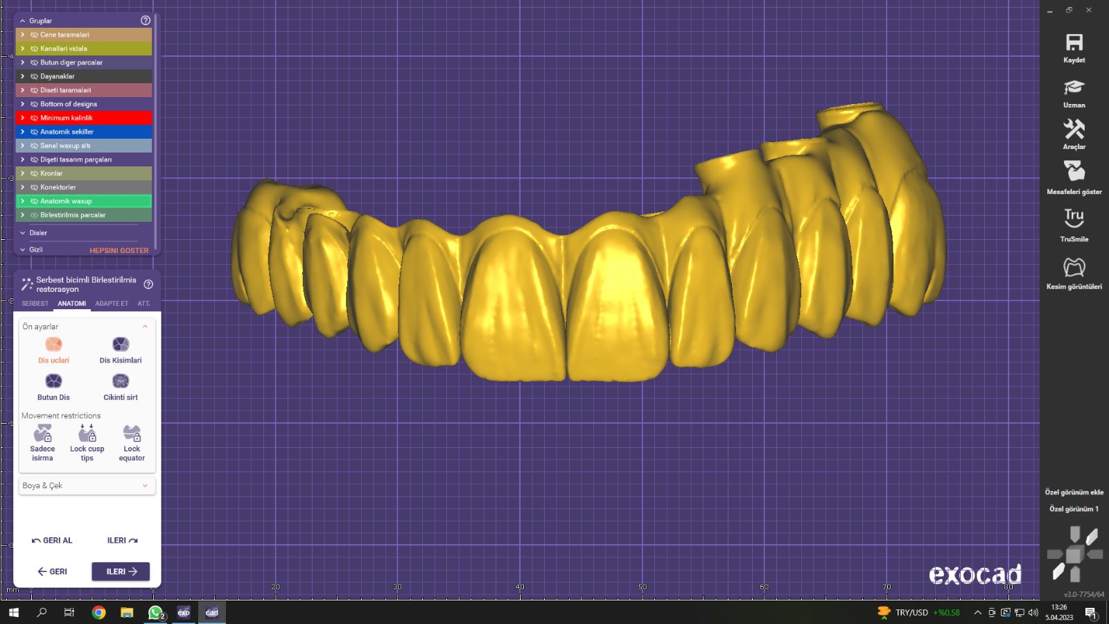 Screw-retained implant bridge