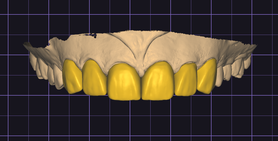 Design service for crown, bridges and implants