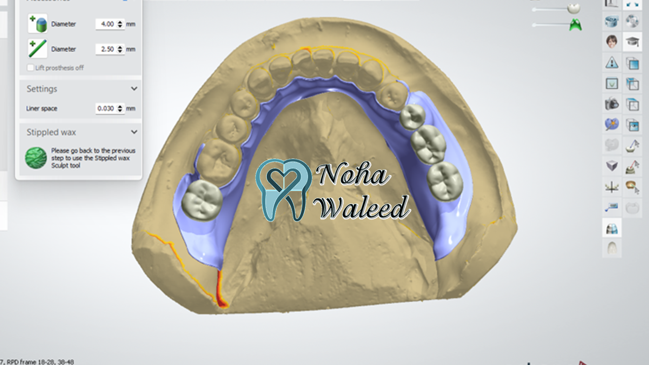 Partial denture framework