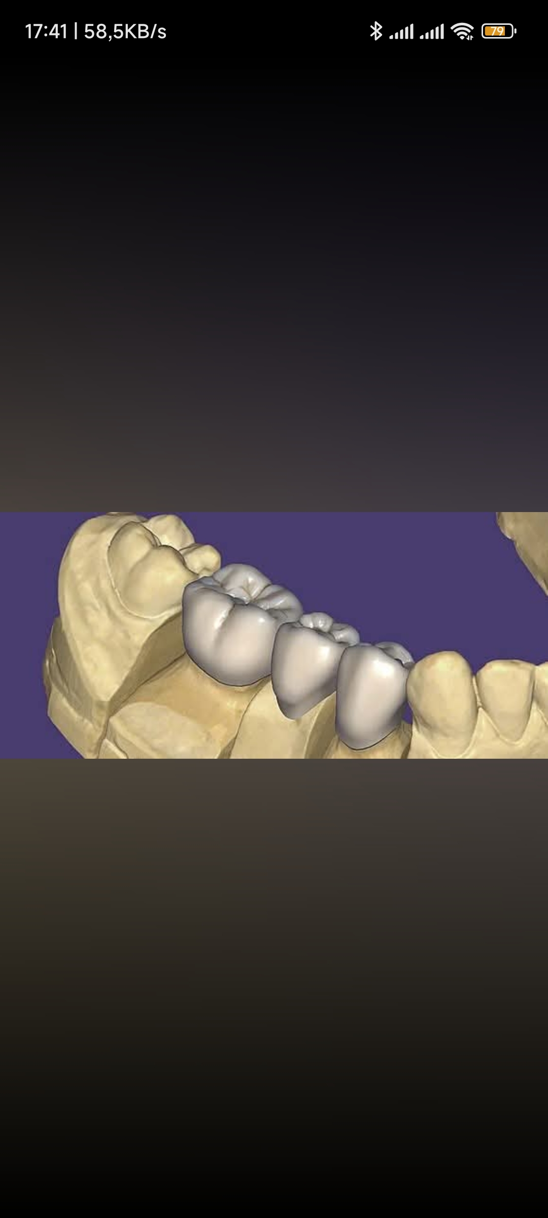 Giải Pháp Thiết Kế Răng Toàn Diện Cho Phòng Lab