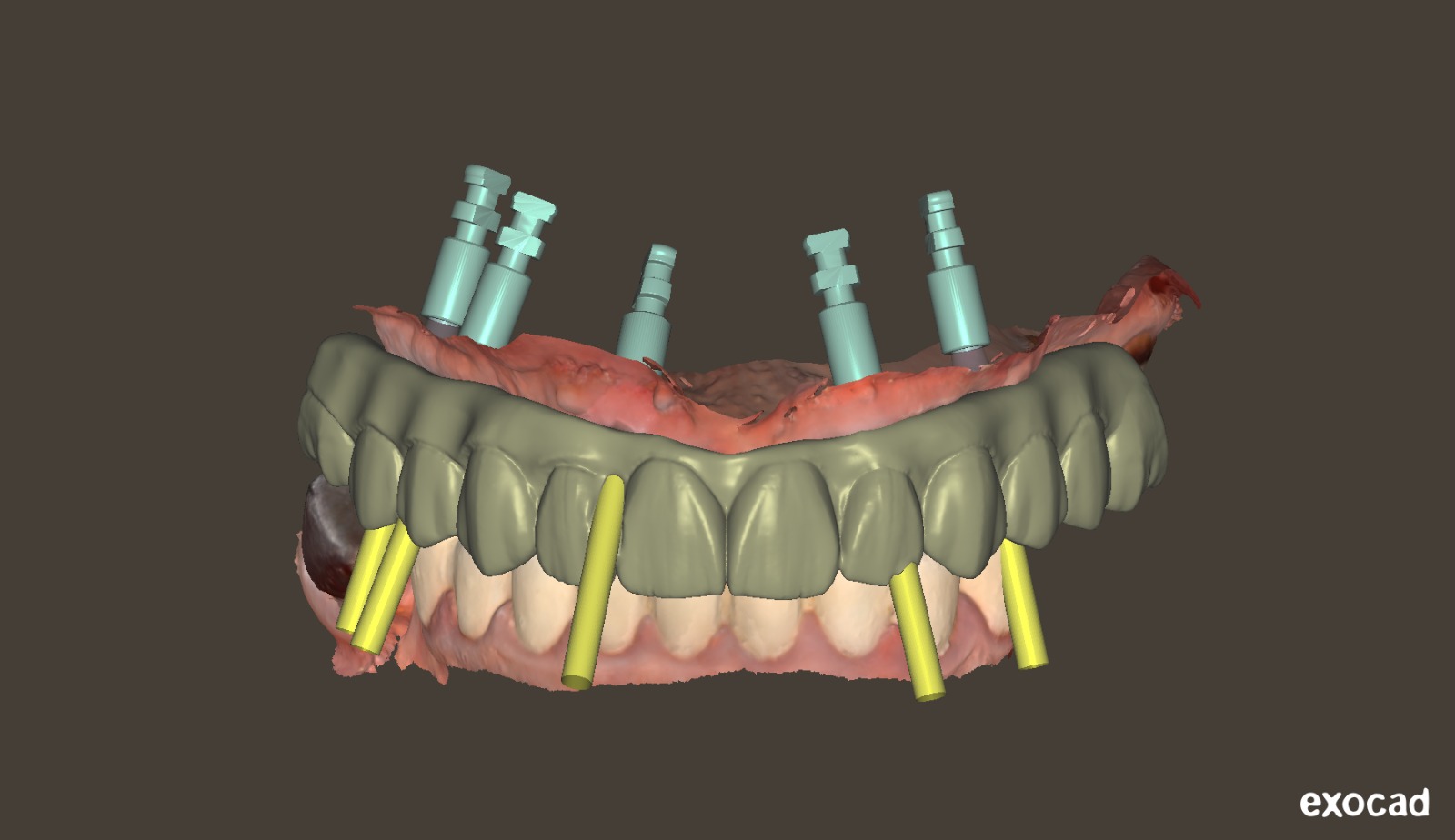 Image 3