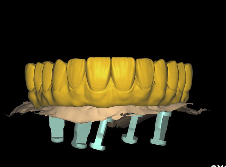 Image 4