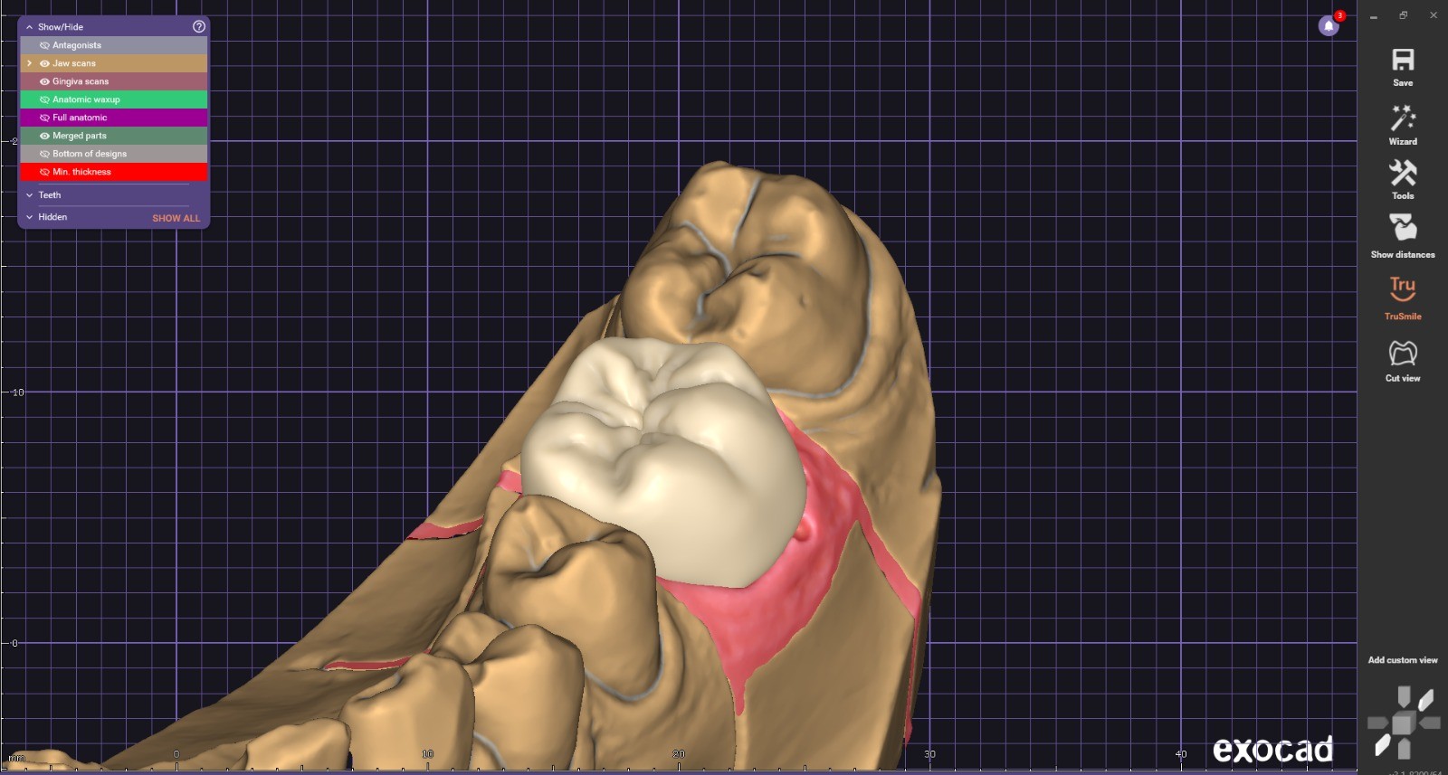 Image 3