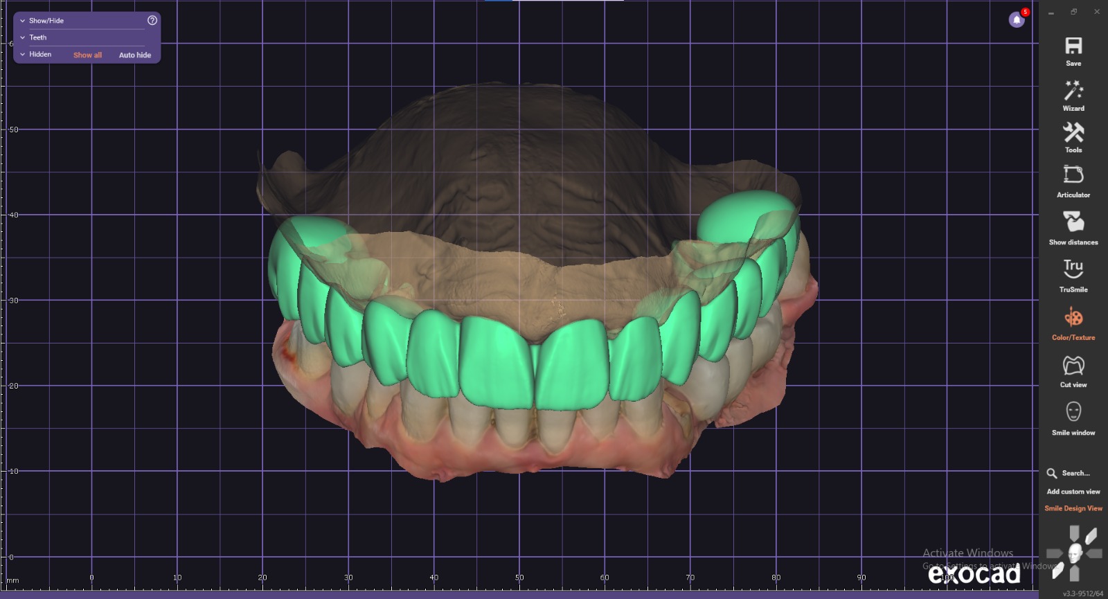 Image 2