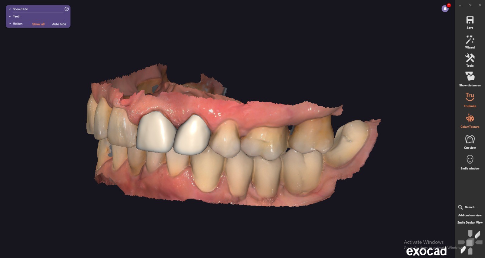 Image 2