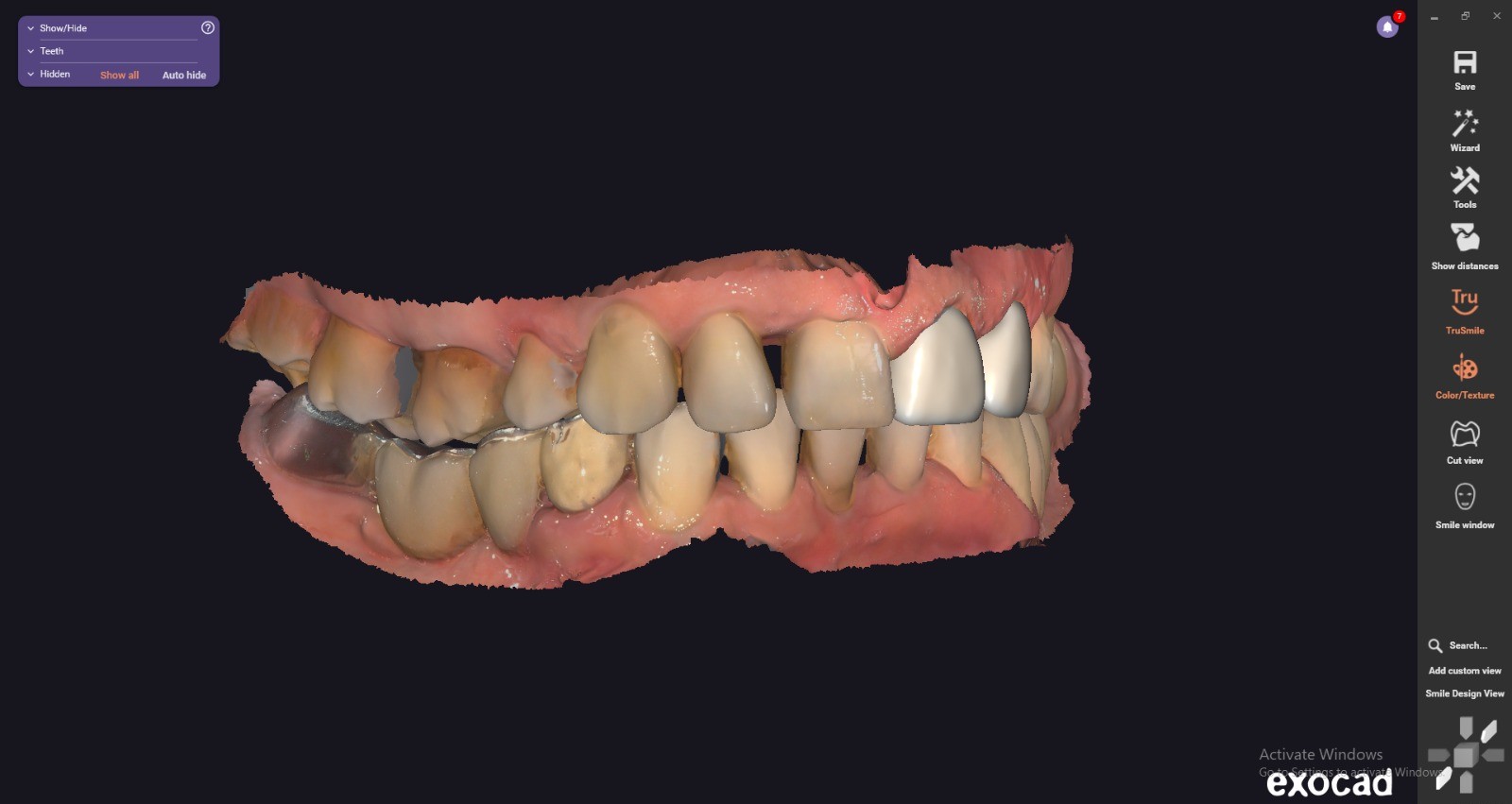 Image 3